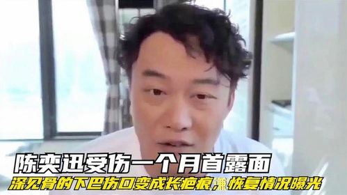 陈奕迅下巴受伤后的首次露面