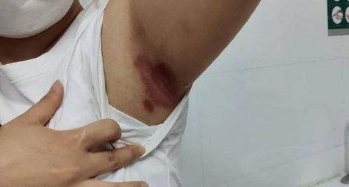 夏天狐臭星人必看！实测5个去异味妙招，轻松拿捏清爽无味夏天