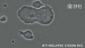 CAR-NK疗法带来抗癌新希望：化疗失效、靶向耐药后，肿瘤竟奇迹消失？