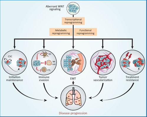 癌细胞进行上皮-间充质转化过程示意图