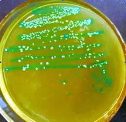 李斯特菌污染食物示意图