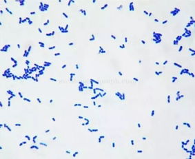 显微镜下的李斯特菌样本