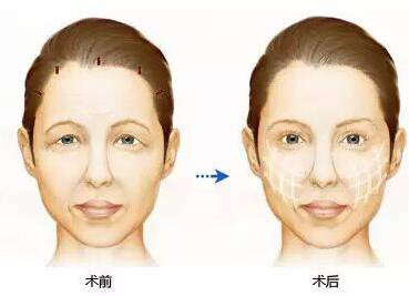 因频繁挖鼻孔导致面部感染的年轻人