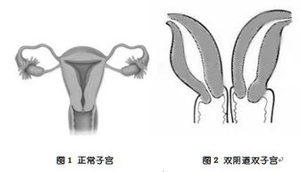 30岁女子脱发被误认奶奶：一场与自我和命运的抗争