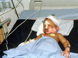 韩国空难幸存者接受治疗照片