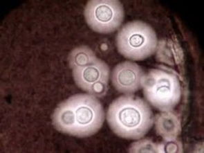 哈密瓜是唯一带李斯特菌的水果？真相远比你想的复杂