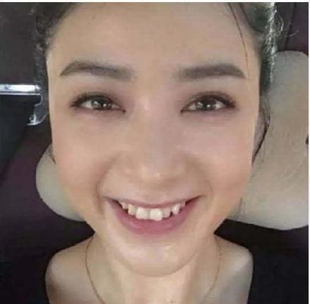 马斯克眼角淤青引热议，背后真相竟与星舰试飞有关？