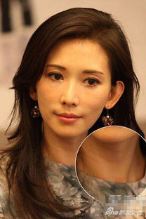 林志玲回应缩脖子事件：真相背后的沉默与风波