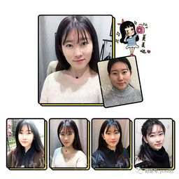 亲身经历：水光针美容变毁容，我全身过敏的真实记录