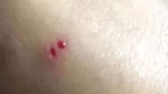 女子被蛇咬伤现场照片