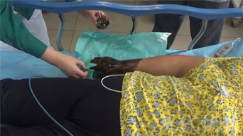 亲历三亚毒蛇咬伤悲剧：妻子被蛇咬送医不治，医生建议竟要带蛇尸体