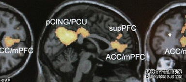 科学家在实验室进行脑部扫描实验场景