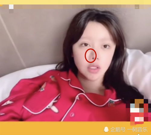 韩安冉直播展示面部状态