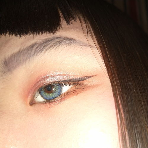 男童患病眼睛如灯泡，背后真相令人心疼又感动