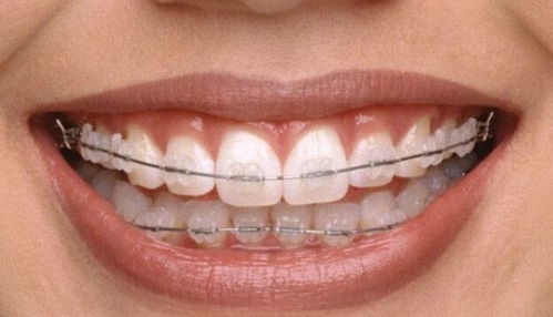 北大韦神牙齿脱落 家属称患牙周炎｜从口腔健康看生命警钟