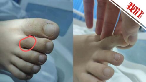 三亚女游客疑被不明物咬伤身亡事件：卫健委通报细节曝光，真相令人揪心