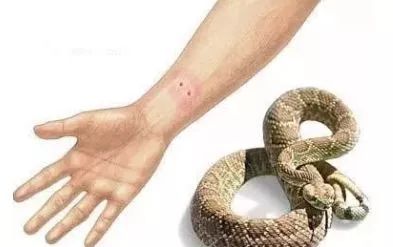 男子被毒蛇咬伤忍痛去抓又来一口！网友：这是武侠小说情节吧？