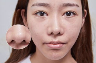 明星常用美容项目对比