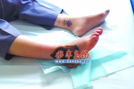 医院为何不常备抗蛇毒血清？一位市民的亲身经历揭开真相