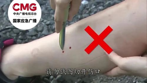女子被不明物咬伤现场