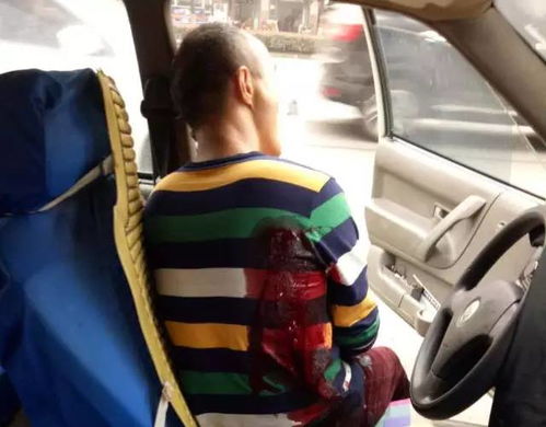 “韦神”的牙不是小事：一次拖延引发的致命危机