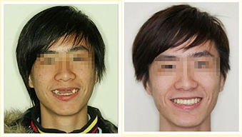 韦神牙齿问题引关注 家属回应：从小不吃荤 身体状况惹担忧