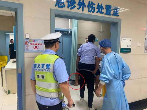 男子被毒蛇咬伤 当场打死拎着就医！这波操作太硬核了