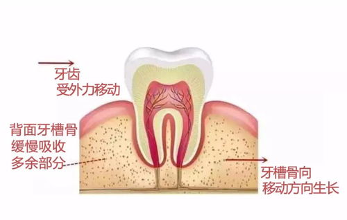 牙齿松动脱落示意图