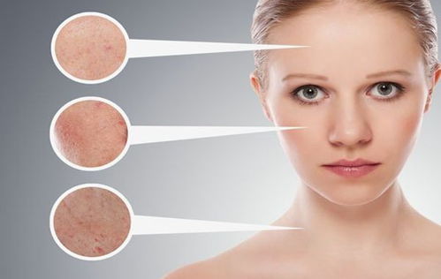 使用视黄醇后皮肤过敏过程图