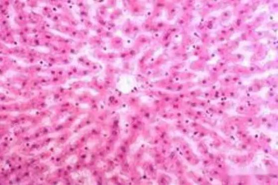 牙龈卟啉单胞菌显微图像