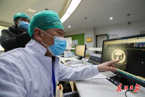 医生正在查看CT影像