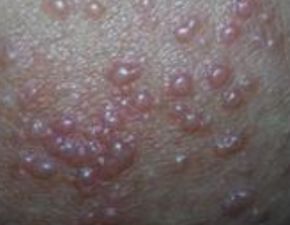 湿厕纸到底是不是智商税？我用了三年，终于找到真相