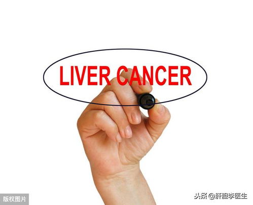 钇-90微球靶向攻击肿瘤示意图