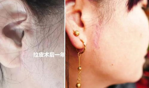 倪维国伤疤特写