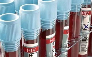 大学生HIV感染现状：一个不容忽视的健康警钟