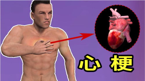 心梗常见症状示意图