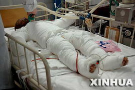 受伤儿童接受治疗