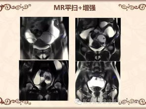 下腹部不适示意图