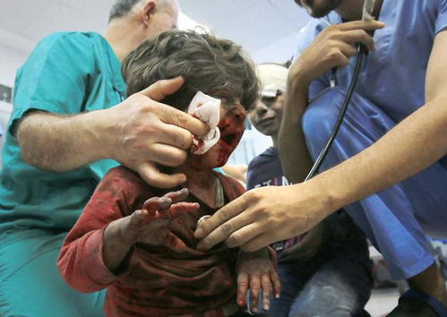 加沙母亲抱着瘦弱孩子