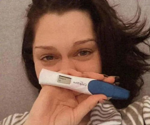 结石姐手术后的情况