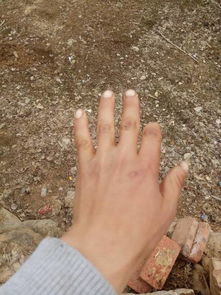 央视揭露：白家电诈园区骇人听闻的虐待手段