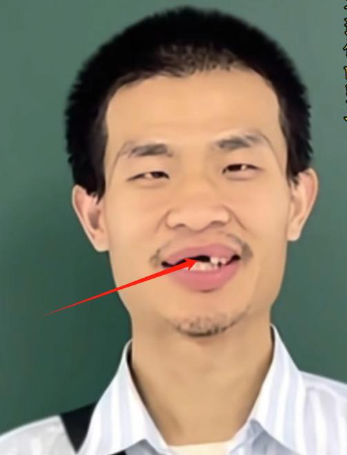 韦东奕看牙背后的故事：牙周炎困扰多年的数学天才