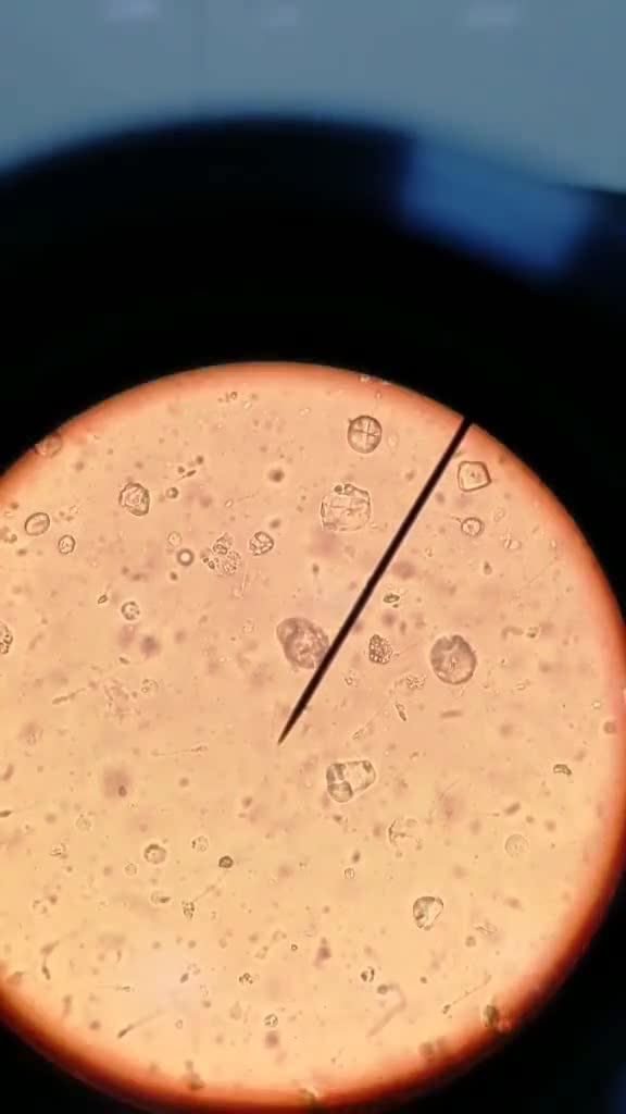 被酒精影响的细胞