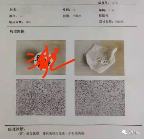 免费版抗癌‘神药’谢幕背后的那些事儿