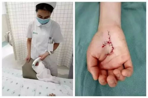 显微镜下肌腱组织