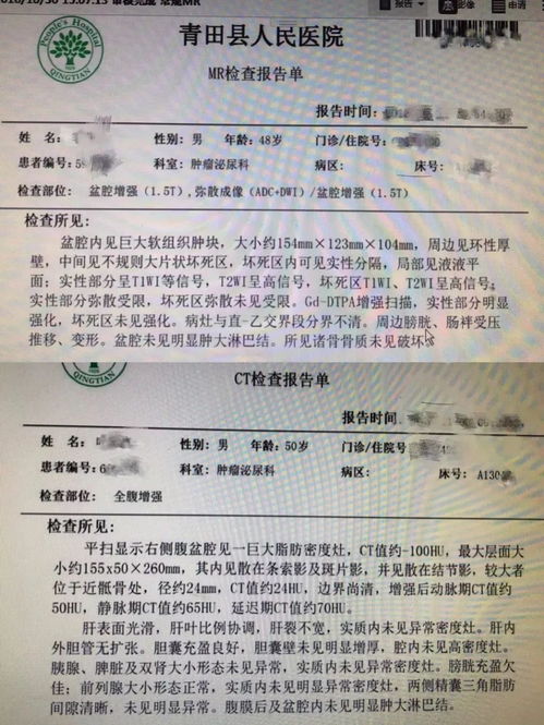 体检10年未查出癌症？当事人怒怼体检机构！