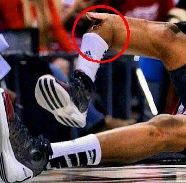 BLG对战G2，强势3:0晋级！