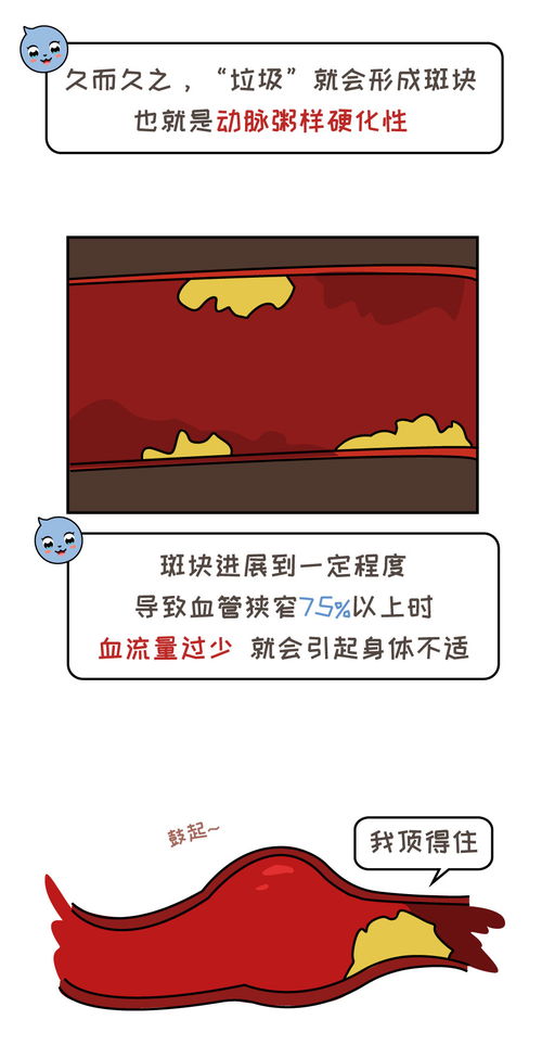 血管堵塞示意图