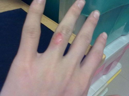 72岁老人坐石头10秒，屁股竟被烫糊！高温真这么可怕？