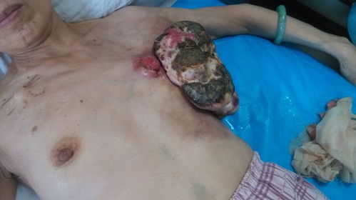 原神可莉被恶搞，贴吧事件引发众怒！